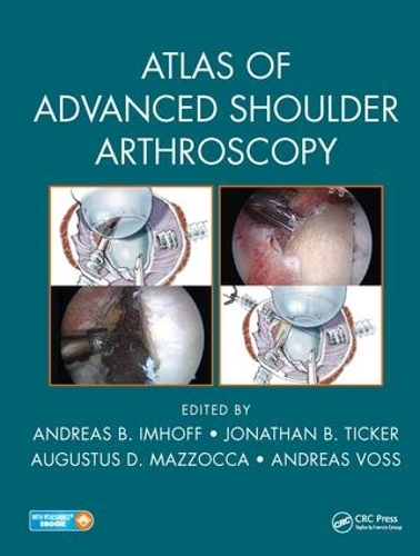 Бумажная книга «Atlas of Advanced Shoulder Arthroscopy» - фото №1