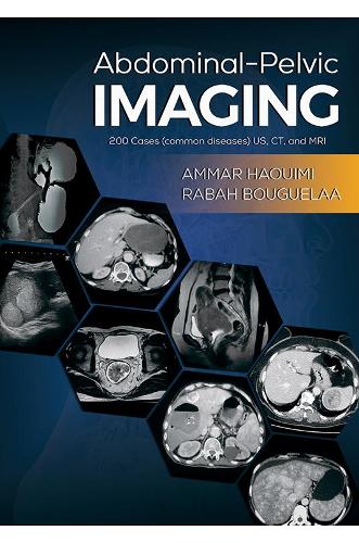 Бумажная книга «Abdominal-Pelvic Imaging: 200 Cases (Common Diseases): US, CT and MRI», авторов Аммар Хауими, Рабах Бугелаа - фото №1