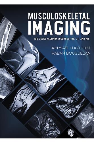 Бумажная книга «Musculoskeletal Imaging: 100 Cases (Common Diseases) US, CT and MRI», авторов Аммар Хауими, Рабах Бугелаа - фото №1