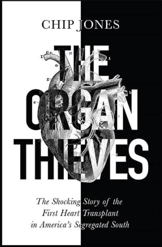 Бумажная книга «The Organ Thieves», автор Чип Джонс - фото №1