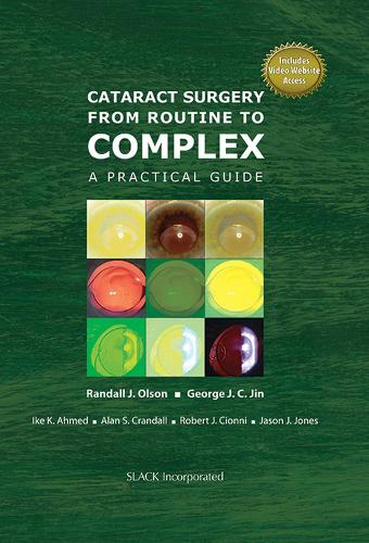 Бумажная книга «Cataract Surgery from Routine to Complex: A Practical Guide», авторов Алан С. Крэндалл, Джордж Джей Си Джин, Айк К. Ахмед, Джейсон Дж. Джонс, Рэндалл Дж. Олсон, Роберт Дж. Чионни - фото №1