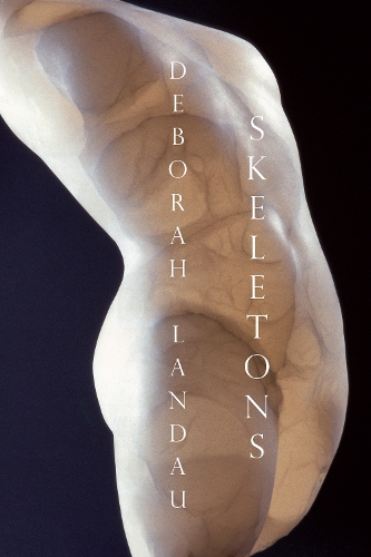 Паперова книга «Skeletons», автор Дебора Ландау - фото №1