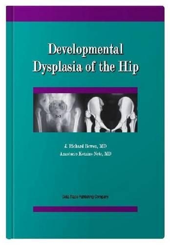 Бумажная книга «Developmental Dysplasia of the Hip», авторов Анастасио Котзиас-Нето, Дж. Ричард Боуэн - фото №1