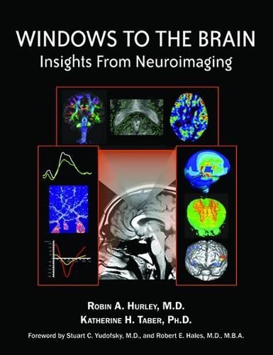 Паперова книга «Windows to the Brain: Insights From Neuroimaging», авторів Кетрін Х. Табер, Робін А. Херлі - фото №1