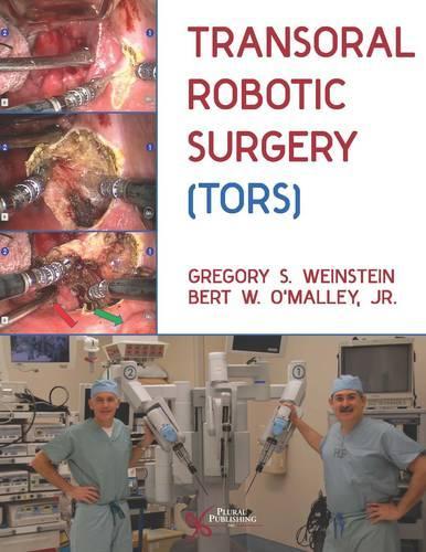 Бумажная книга «Transoral Robotic Surgery (TORS)», авторов Берт В. О'Мэлли, Грегори С. Вайнштейн - фото №1