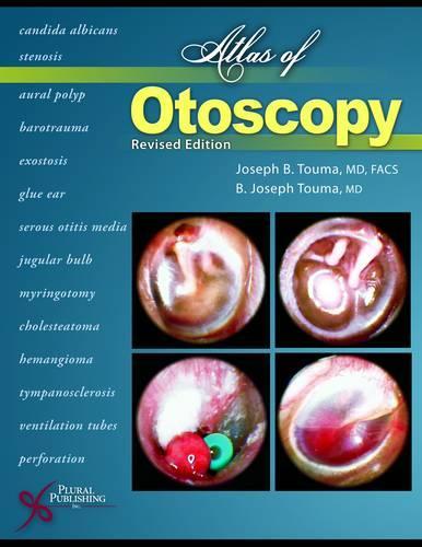 Бумажная книга «Atlas of Otoscopy», авторов Б. Джозеф Тума, Джозеф Б. Тума - фото №1