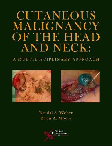 Бумажная книга «Cutaneous Malignancy of the Head and Neck: A Multidisciplinary Approach», авторов Брайан А. Мур, Рэндал С. Вебер - фото №1