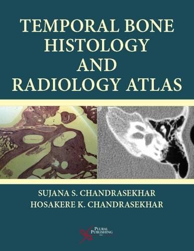 Паперова книга «Temporal Bone Histology and Radiology Atlas», автор Суджана С. Чандрасехар - фото №1