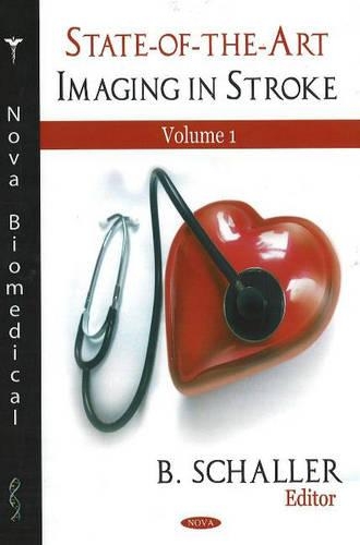 Паперова книга «State-of-the-Art Imaging in Stroke, Volume 1» - фото №1