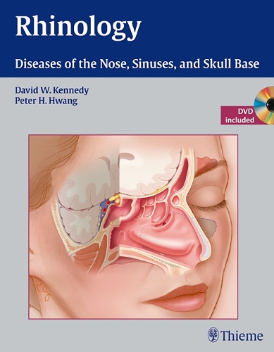 Бумажная книга «Rhinology: Diseases of the Nose, Sinuses, and Skull Base», авторов Дэвид Кеннеди, Питер Х. Хванг - фото №1