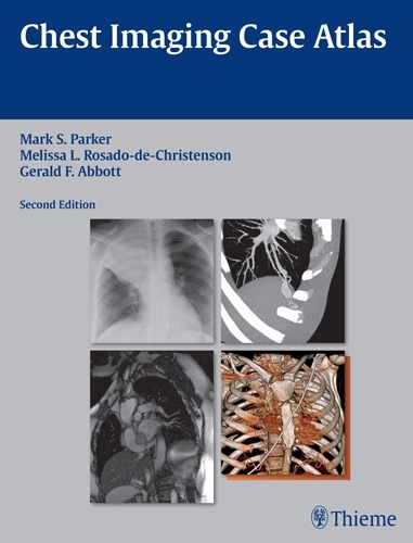 Бумажная книга «Chest Imaging Case Atlas», авторов Джеральд Ф. Эббот, Марк С. Паркер, Мелисса Л. Росадо-де-Кристенсон - фото №1