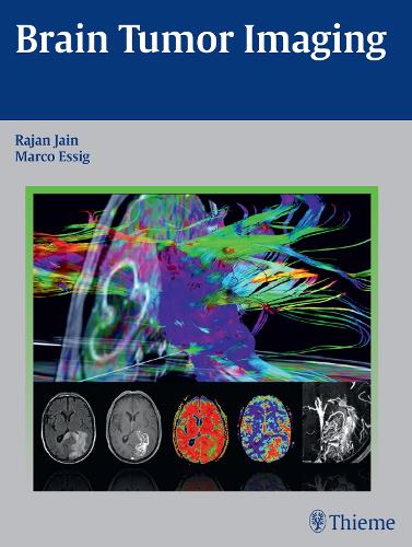 Паперова книга «Brain Tumor Imaging», авторів Марко Ессіг, Раджан Джайн - фото №1