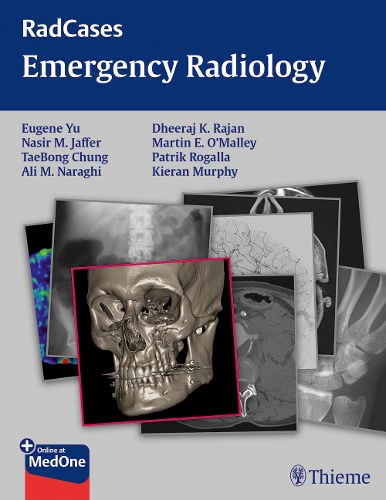Паперова книга «Radcases Emergency Radiology», авторів Алі М. Нарагі, Дірадж Раджан, Юджин Ю, Кіран Мерфі, Мартін О'Меллі, Насір Джаффер, Тхебон Чунг - фото №1