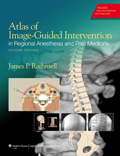 Бумажная книга «Atlas of Image-Guided Intervention in Regional Anesthesia and Pain Medicine», автор Джеймс П. Ратмелл - фото №1