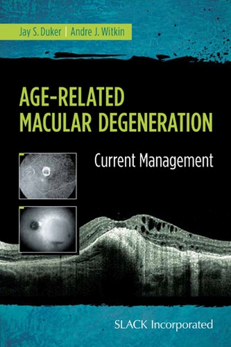 Бумажная книга «Age-Related Macular Degeneration: Current Management», авторов Андре Виткин, Джей Дюкер - фото №1