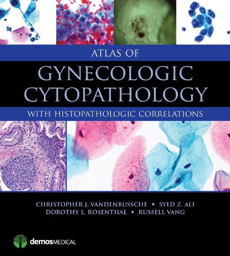 Паперова книга «Atlas of Gynecologic Cytopathology: With Histopathologic Correlations», авторів Крістофер Дж. ВанденБуше, Дороті Л. Розенталь, Рассел Ванг, Саїд З. Алі - фото №1