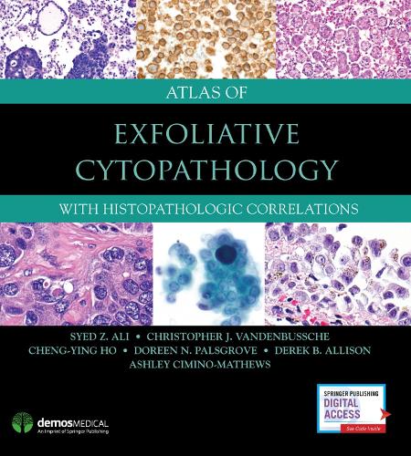 Бумажная книга «Atlas of Exfoliative Cytopathology: With Histopathologic Correlations», авторов Эшли Чимино-Мэтьюс, Чэн-Ин Хо, Кристофер Дж. ВанденБуше, Дерек Б. Эллисон, Дорин Н. Палсгроув, Саид З. Али - фото №1