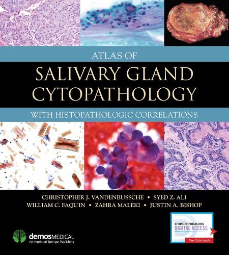 Паперова книга «Atlas of Salivary Gland Cytopathology: With Histopathologic Correlations», авторів Крістофер Дж. ВанденБуше, Джастін А. Бішоп, Саїд З. Алі, Вільям К. Факін, Захра Малекі - фото №1