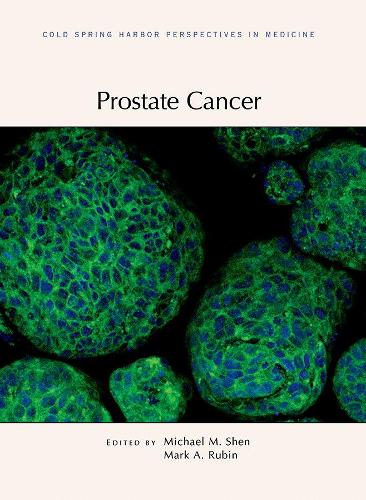 Паперова книга «Prostate Cancer» - фото №1