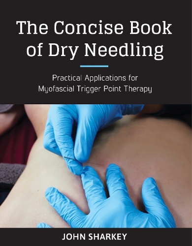 Бумажная книга «The Concise Book of Dry Needling: A Practitioner's Guide to Myofascial Trigger Point Applications», автор Джон Шарки - фото №1