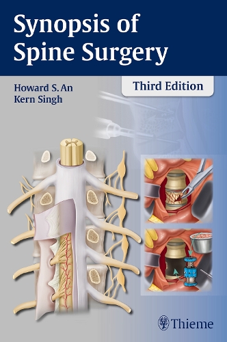 Паперова книга «Synopsis of Spine Surgery», авторів Говард С. Ан, Керн Сінгх - фото №1