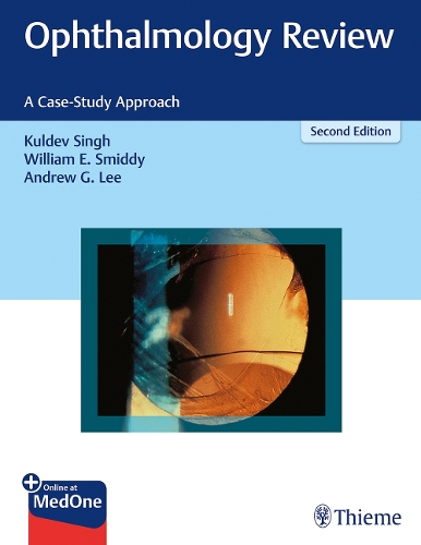 Паперова книга «Ophthalmology Review: A Case-Study Approach», авторів Ендрю Г. Лі, Кулдев Сінгх, Вільям Е. Смідді - фото №1