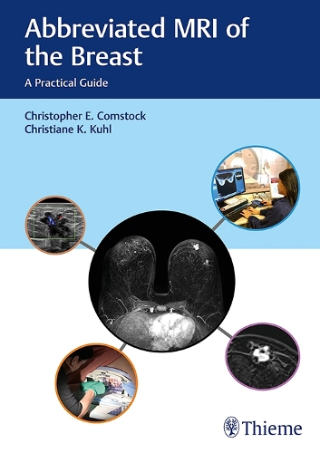 Бумажная книга «Abbreviated MRI of the Breast: A Practical Guide», авторов Кристиана Кюль, Кристофер Э. Комсток - фото №1
