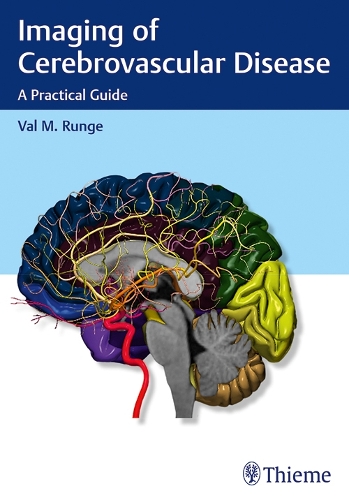 Паперова книга «Imaging of Cerebrovascular Disease: A Practical Guide», автор Вал М. Рунге - фото №1