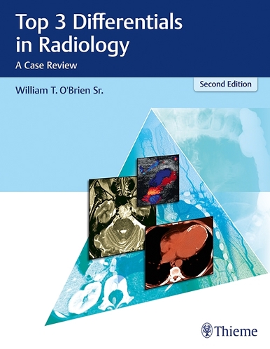 Паперова книга «Top 3 Differentials in Radiology: A Case Review», автор Вільям Т. О'Браєн - фото №1