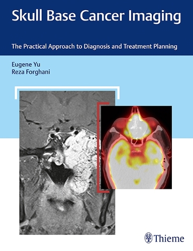 Бумажная книга «Skull Base Cancer Imaging: The Practical Approach to Diagnosis and Treatment Planning», авторов Юджин Ю, Реза Форгани - фото №1
