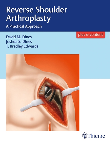 Бумажная книга «Reverse Shoulder Arthroplasty: A Practical Approach», авторов Дэвид М. Дайнс, Джошуа Динес, Т Брэдли Эдвардс - фото №1