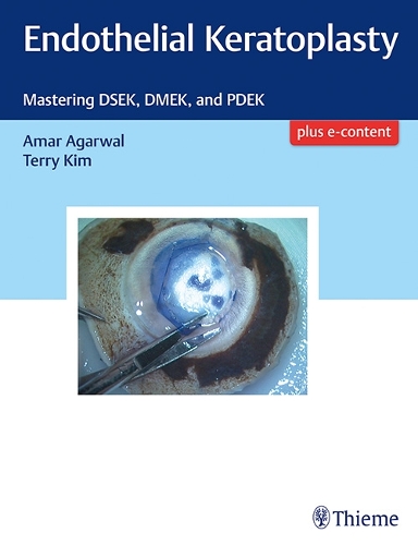 [object Object] «Endothelial Keratoplasty: Mastering DSEK, DMEK, and PDEK», авторів Амар Агарвал, Террі Кім - фото №1