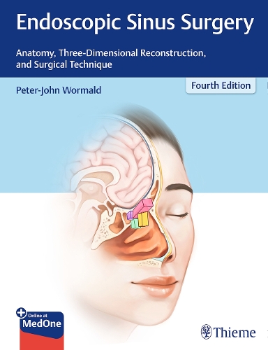 Paper book «Endoscopic Sinus Surgery: Anatomy, Three-Dimensional Reconstruction, and Surgical Technique», author Peter J. Wormald - фото №1