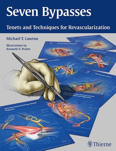 Паперова книга «Seven Bypasses: Tenets and Techniques for Revascularization», автор Майкл Т. Лоутон - фото №1