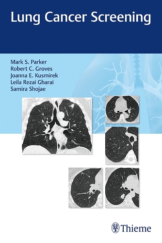 Бумажная книга «Lung Cancer Screening», авторов Джоанна Кусмирек, Лейла Резаи Гараи, Марк Паркер, Роберт Гровс, Самира Шоджаи - фото №1