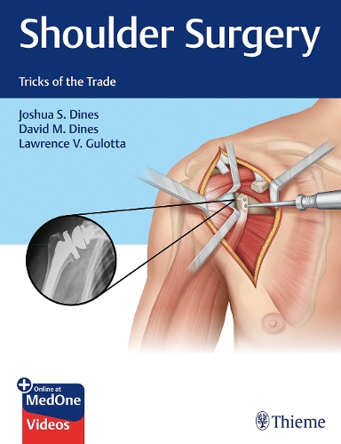 Бумажная книга «Shoulder Surgery: Tricks of the Trade», авторов Дэвид М. Дайнс, Джошуа Динес, Лоуренс В. Гулотта - фото №1