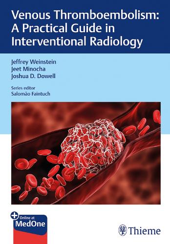 Паперова книга «Venous Thromboembolism: A Practical Guide in Interventional Radiology», авторів Джит Міноча, Джеффрі Вайнштейн, Джошуа Доуелл - фото №1