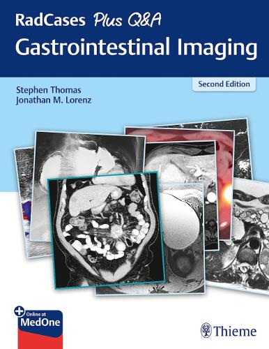Паперова книга «RadCases Plus Q&A Gastrointestinal Imaging», авторів Джонатан М. Лоренц, Стівен Томас - фото №1