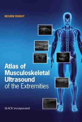 Бумажная книга «Atlas of Musculoskeletal Ultrasound of the Extremities», автор Мохини Рават - фото №1