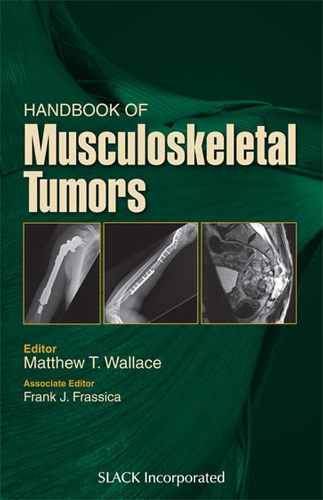 Паперова книга «Handbook of Musculoskeletal Tumors», авторів Френк Фрасіка, Метью Уоллес - фото №1