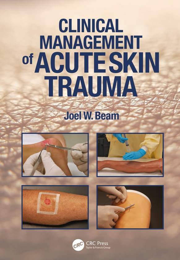 Паперова книга «Clinical Management of Acute Skin Trauma», автор Джоел В. Бім - фото №1