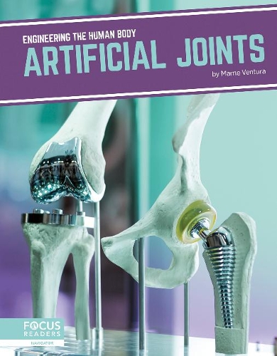 Бумажная книга «Artificial Joints», автор Марна Вентура - фото №1