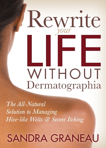 Бумажная книга «Rewrite Your Life Without Dermatographia: The All-Natural Solution to Managing Hive-like Welts and Severe Itching», автор Сандра Грано - фото №1
