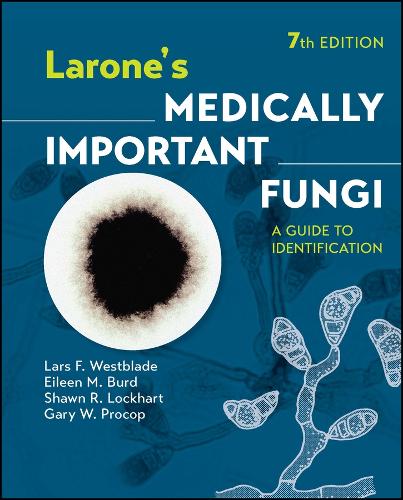 Паперова книга «Larone's Medically Important Fungi: A Guide to Identification», авторів Ейлін М. Берд, Ґері В. Прокоп, Ларс Ф. Вестблейд, Шон Р. Локхарт - фото №1