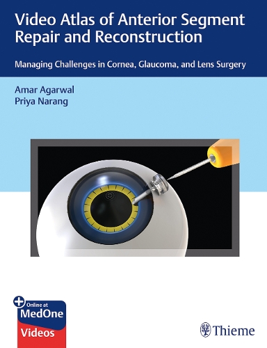 Бумажная книга «Video Atlas of Anterior Segment Repair and Reconstruction: Managing Challenges in Cornea, Glaucoma, and Lens Surgery», авторов Амар Агарвал, Прия Наранг - фото №1