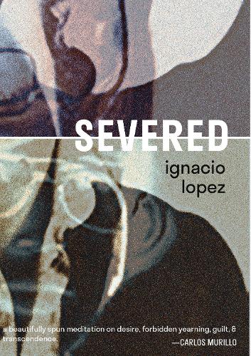 Паперова книга «Severed», автор Ігнасіо Лопес - фото №1
