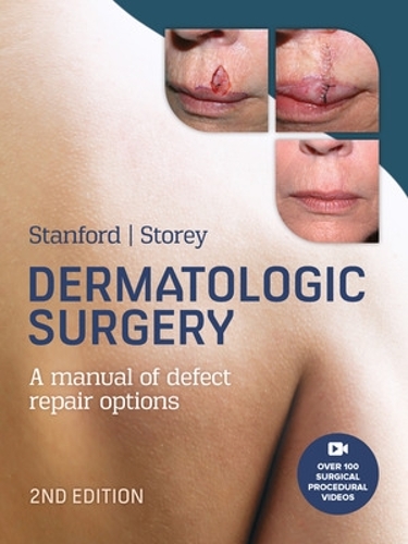 Бумажная книга «Dermatologic Surgery», авторов Дункан Стэнфорд, Лесли Стори - фото №1