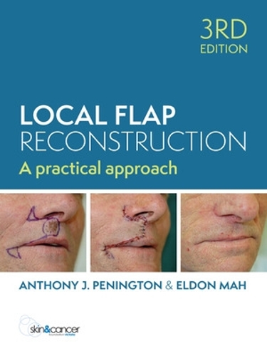 Бумажная книга «Local Flap Reconstruction», автор Энтони Пенингтон - фото №1