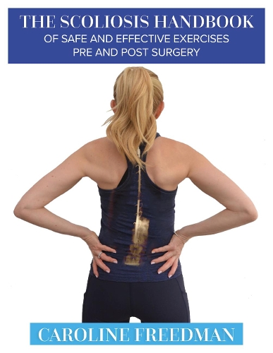 Паперова книга «The Scoliosis Handbook of Safe and Effective Exercises Pre and Post Surgery», автор Керолайн Фрідман - фото №1
