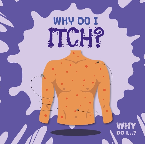 Бумажная книга «Why Do I Itch?», автор Керсти Холмс - фото №1